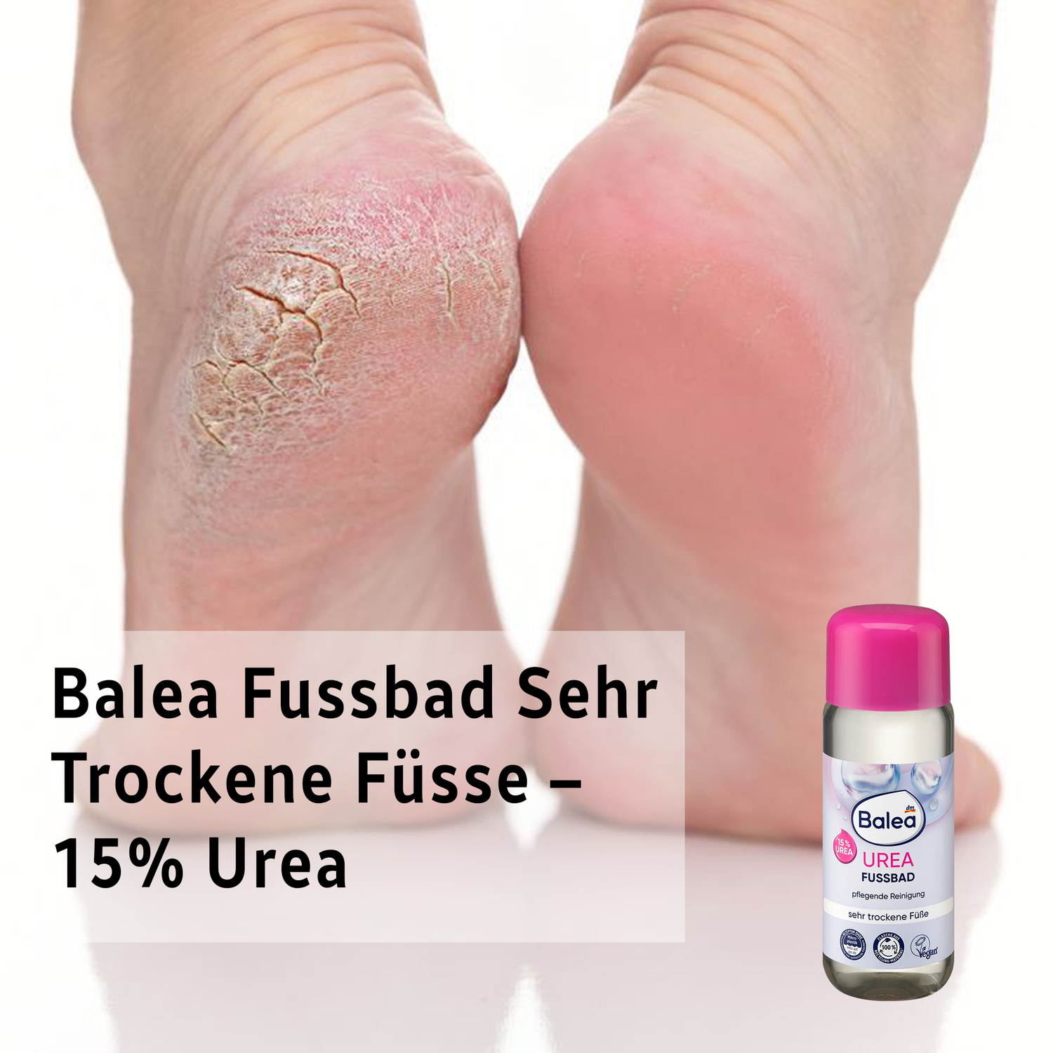 Foot Bath 15% Urea – Balea – Intensive Care for Very Dry Feet (200 ml)