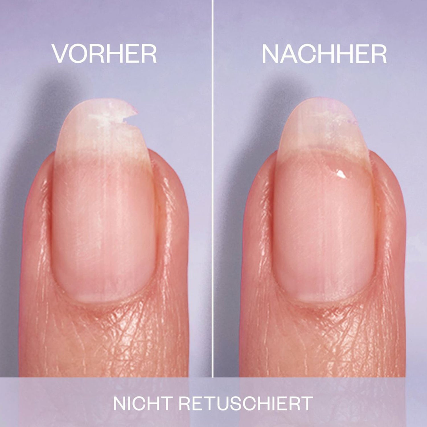 essie Break Fix Liquid Nail Patch – Nail Repair Treatment – Transparent – 7 ml